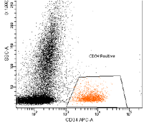 Bone marrow aspirate flow cytometric immunophenotypic analysis demonstrated a prominent CD34 positive blast population.